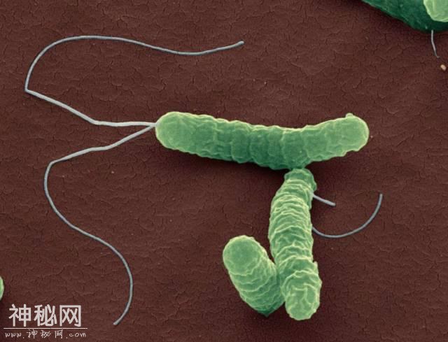一人感染全家被传染，这种细菌我国超一半人感染-1.jpg
