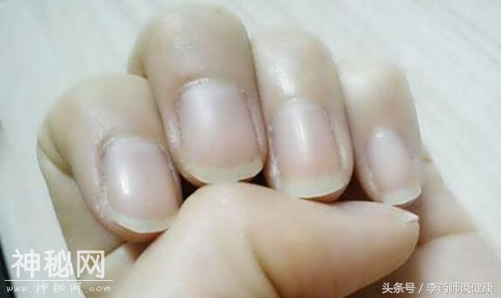 5b400004287742f88370