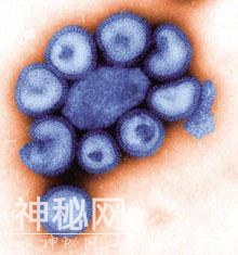 末日病毒来袭？盘点人类史上十大致命病毒-6.jpg