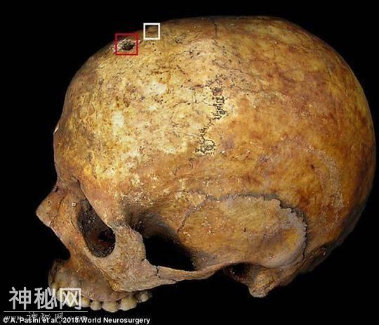 考古发现中世纪孕妇38周时死亡 被埋葬后“生下”胎儿-3.jpg