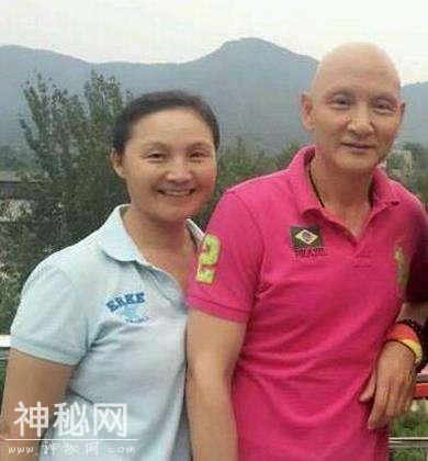 他曾是影视圈的小鲜肉，患怪病头发掉光，因祸得福成“金牌反派”-18.jpg