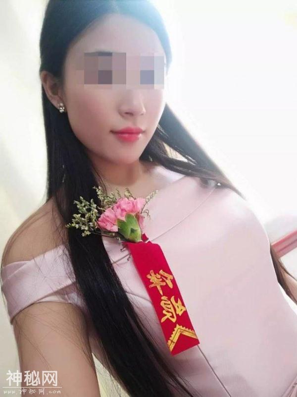 以为只是一场小感冒 24 岁美女最终被截肢-2.jpg