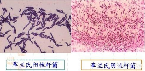 细菌分类有道理，掌握不好这方面知识当不好医生，用错药越治越重-1.jpg