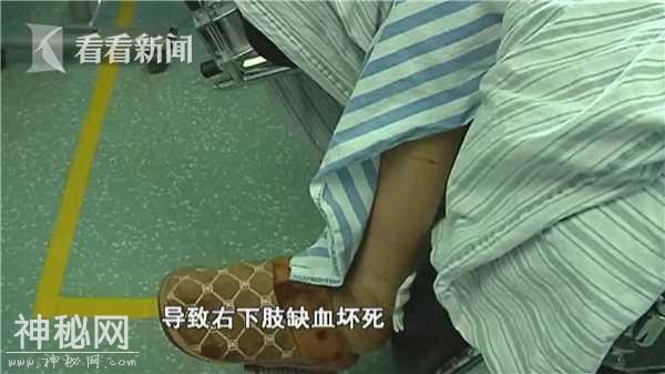 一场感冒竟让24岁女孩右腿截肢 两次病危差点命都没了-14.jpg