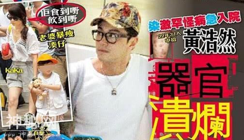 很多人都知道他曾得过怪病 可很少人关注他的后续故事-5.jpg