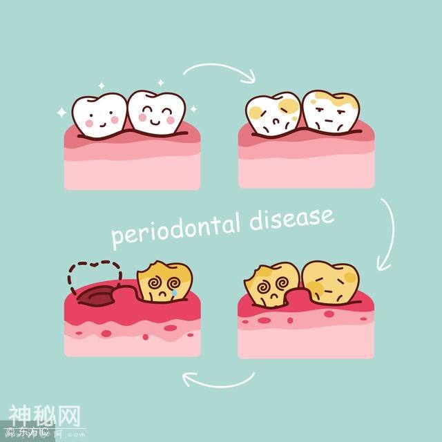 这些细菌正在偷偷“吃掉”你的牙齿，12道题自测牙病风险-2.jpg