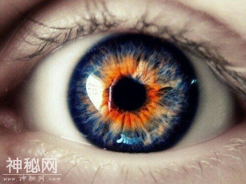 其实每个人眼睛都有个宇宙！-8.jpg