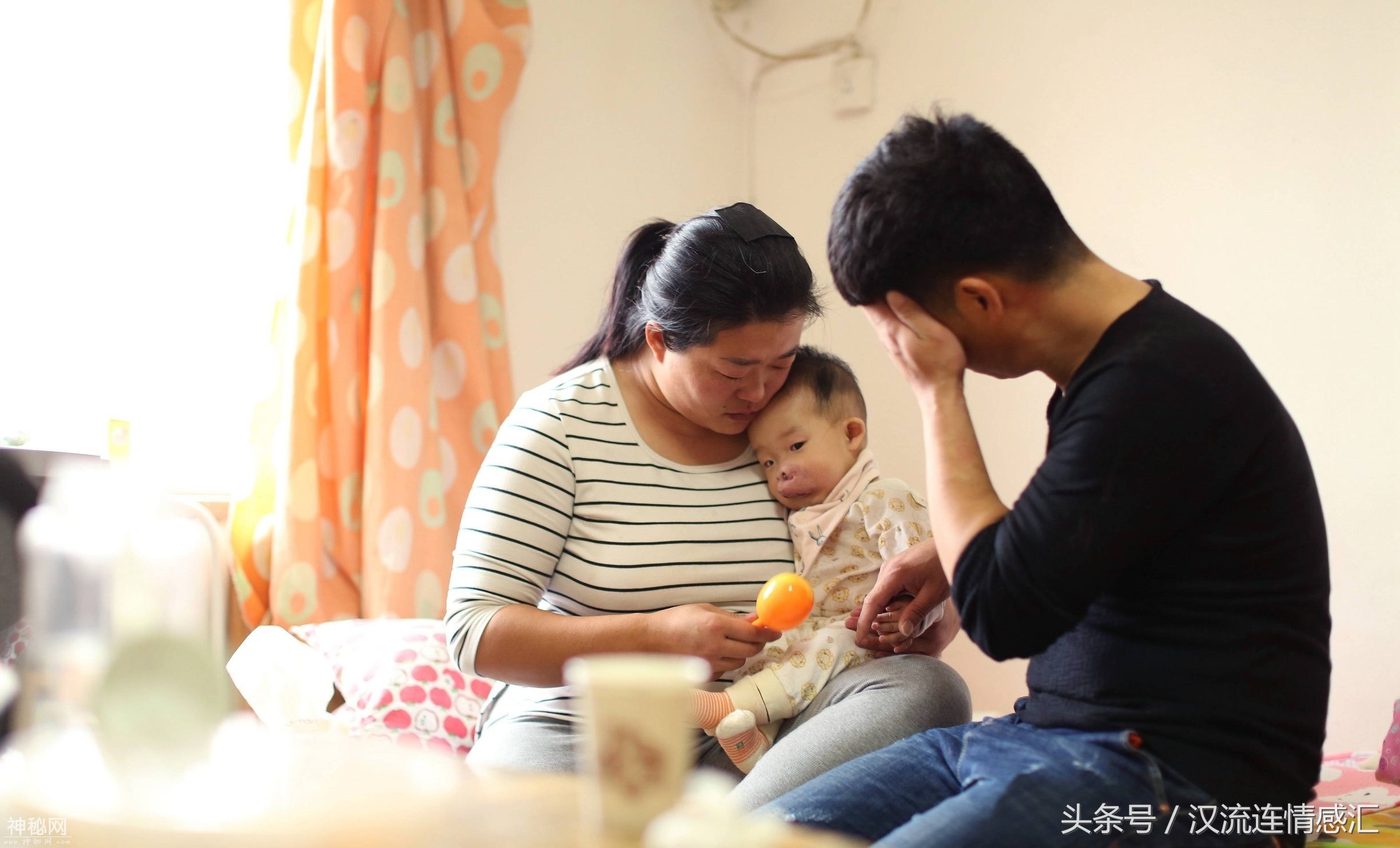 一岁的娃娃得怪病长了个猪鼻子，被外人嘲笑是八戒急坏了爸妈-3.jpg