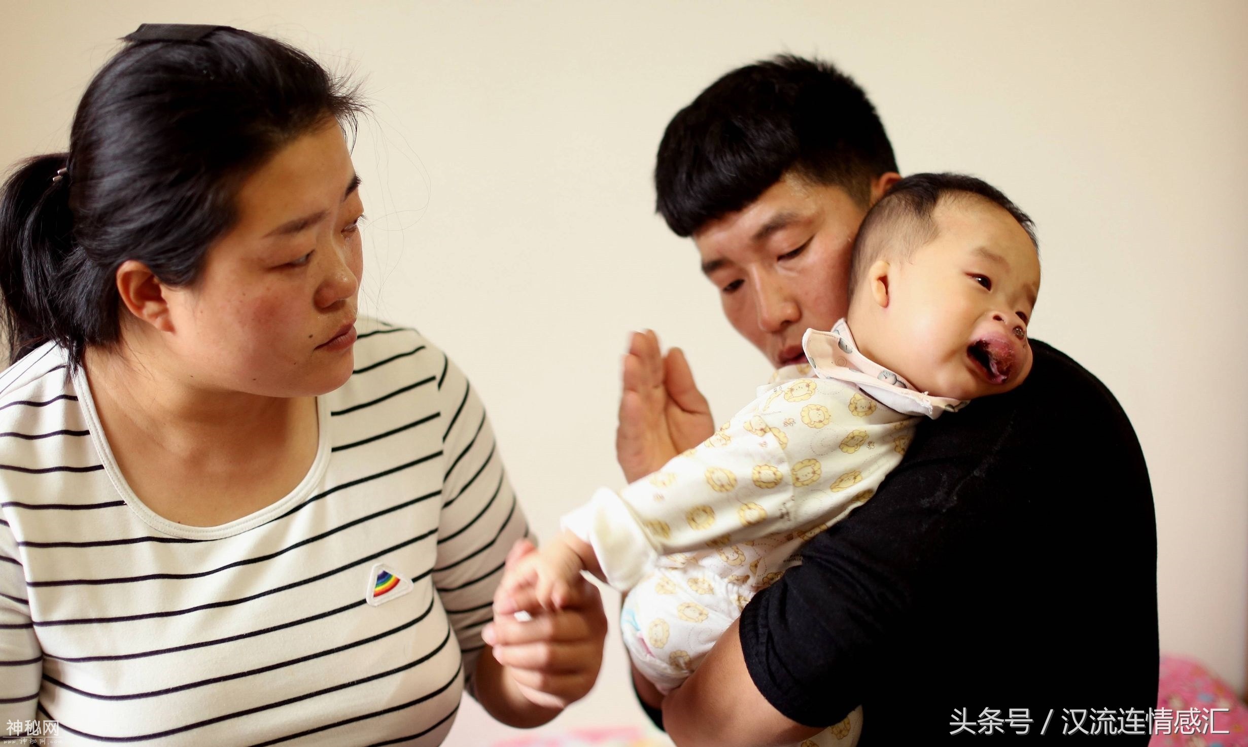 一岁的娃娃得怪病长了个猪鼻子，被外人嘲笑是八戒急坏了爸妈-4.jpg
