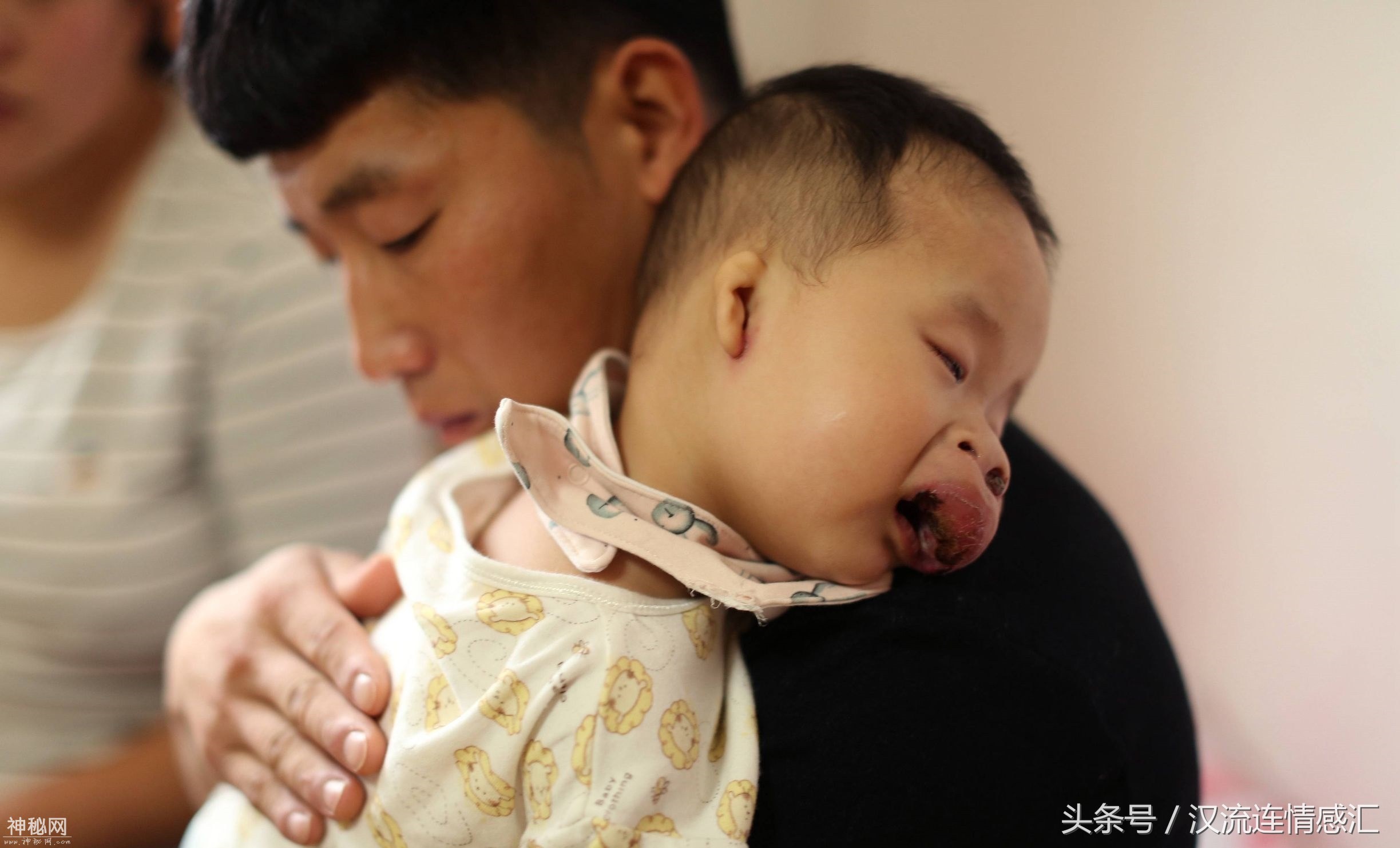 一岁的娃娃得怪病长了个猪鼻子，被外人嘲笑是八戒急坏了爸妈-6.jpg