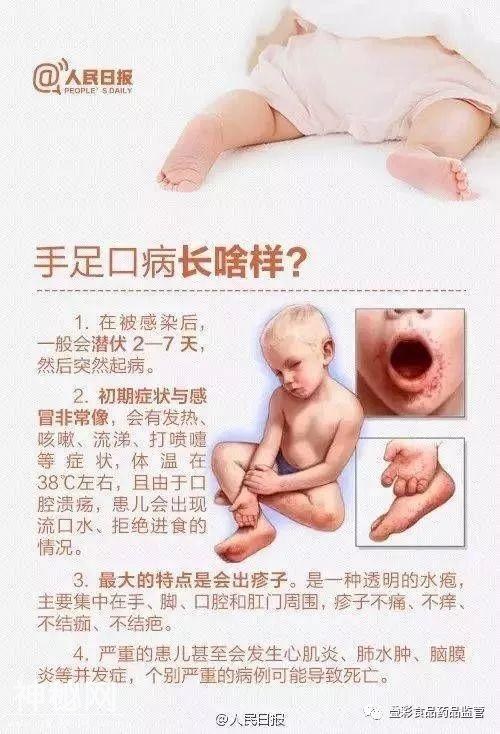 官方提醒！桂林这种病毒进入高发期，传染性极强，这类人要尤其当心！-11.jpg