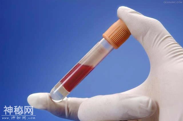 甘油三酯高要怎么吃？4种方法有利于降脂，养血管-2.jpg