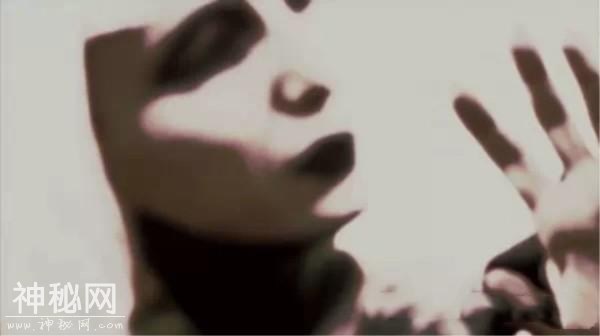 全球十大怪病，你听说过几个？-9.jpg
