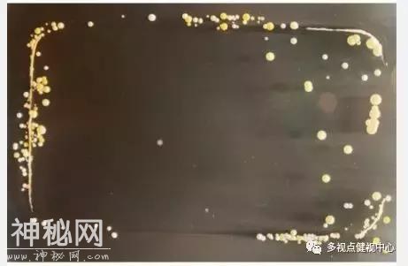 手机不仅伤害视力还暗藏大量恶心的细菌，看完之后都没胃口吃饭了-6.jpg