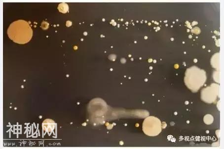 手机不仅伤害视力还暗藏大量恶心的细菌，看完之后都没胃口吃饭了-5.jpg