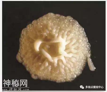 手机不仅伤害视力还暗藏大量恶心的细菌，看完之后都没胃口吃饭了-4.jpg
