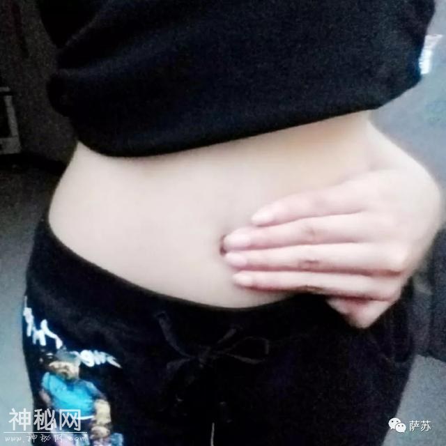 溥仪当真长了双“龙爪”？苏联医生保留下证据，原是患了这种怪病-7.jpg