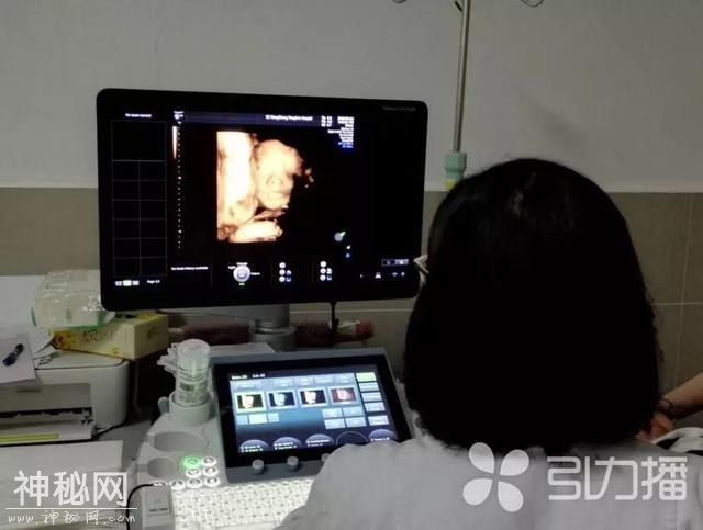 「FM889」准妈妈怀孕5个月，发现胎儿长了个长长的鼻子！-3.jpg