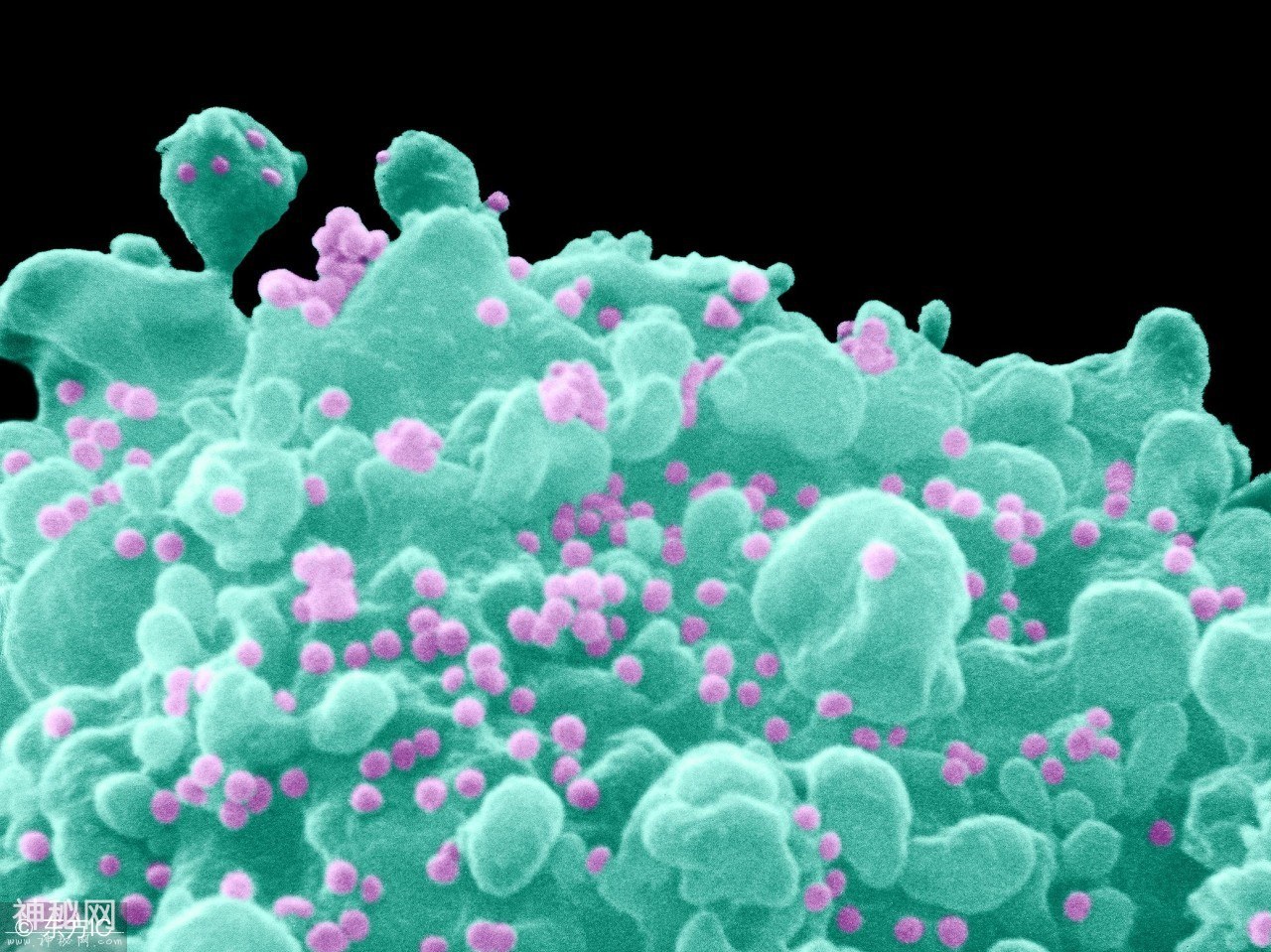 HIV病毒微观形貌-1.jpg