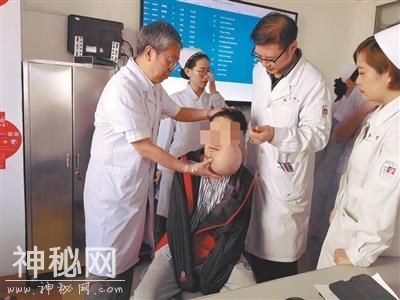 25岁小伙子患怪病 脸上肿瘤大如“小西瓜”-1.jpg