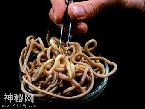 图看人体10大最常见的寄生害虫，个个都是“狠角色”-5.jpg