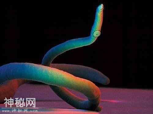 图看人体10大最常见的寄生害虫，个个都是“狠角色”-6.jpg