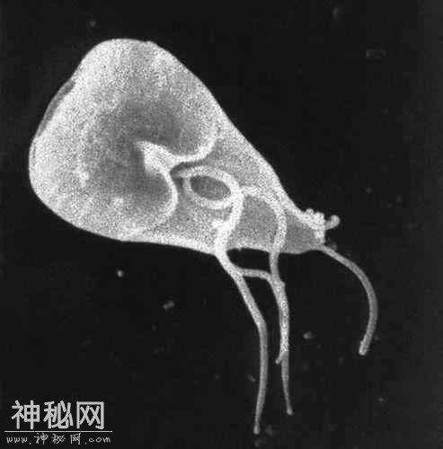 图看人体10大最常见的寄生害虫，个个都是“狠角色”-9.jpg