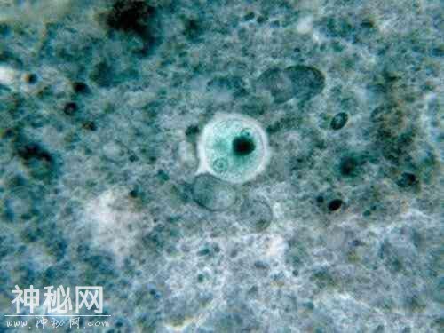 图看人体10大最常见的寄生害虫，个个都是“狠角色”-10.jpg