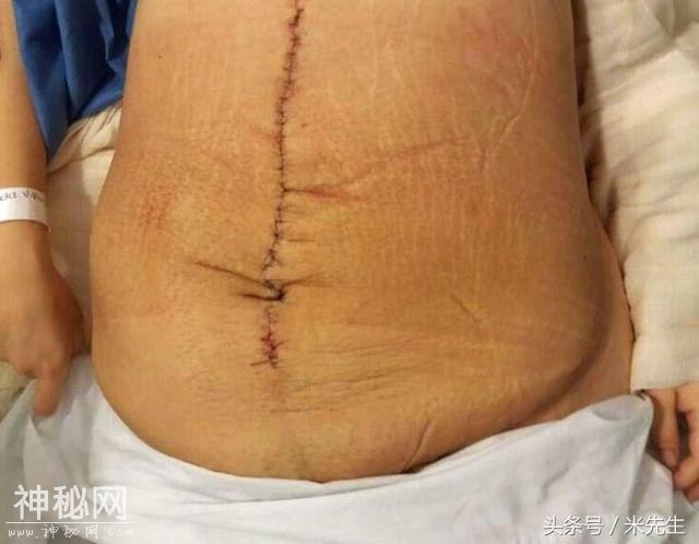 女子生“怪病”如怀孕，被丈夫狠心抛弃，好心院长收留帮救治-7.jpg