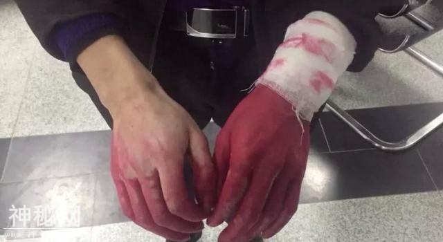 男友因想留住女朋友用墨水装割腕，网友：这女友已看破红尘-4.jpg