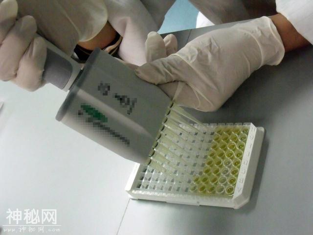 和男朋友接吻过敏，医院要她脱敏治疗，女子用这个方法一分钱没花-2.jpg