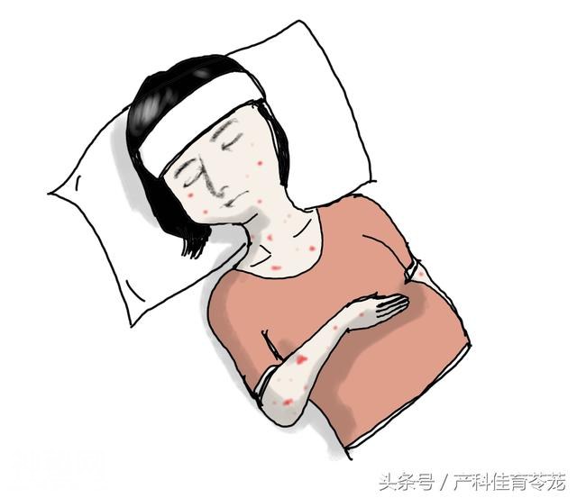 妊娠期感染之风疹病毒-1.jpg