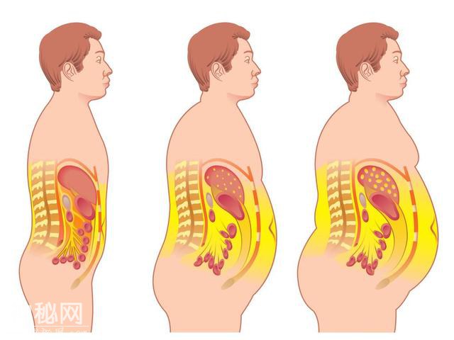 肥胖会导致多种癌症 我们应当怎样避免？-2.jpg