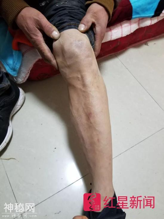 52岁男子造“飞碟”自称外星人 曾造飞行器坠地受伤-13.jpg