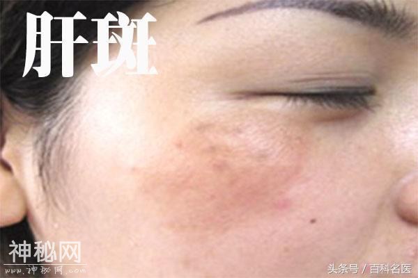 身体8个现象，竟是肝癌信号！-2.jpg