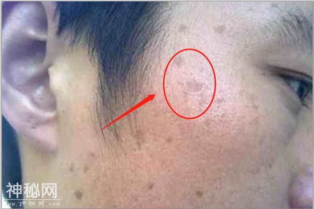 中医 肝不好的人 身体一般有3种现象 多吃1物 排毒素 养护肝-1.jpg