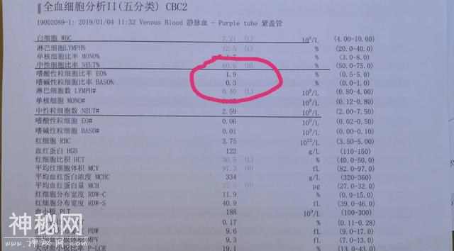 感冒，到底是细菌的还是病毒的？其实常见的就这4种！-8.jpg