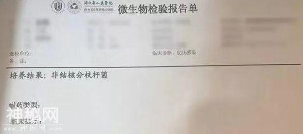 女子打“瘦腿针”后险遭截肢！医生在她腿上发现“神秘细菌”……-8.jpg