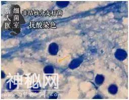女子打“瘦腿针”后险遭截肢！医生在她腿上发现“神秘细菌”……-9.jpg