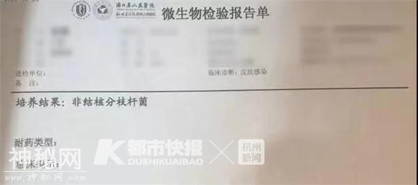 杭州28岁女子打“瘦腿针”后皮肤溃烂险遭截肢，原来是“神秘细菌”惹的祸-4.jpg