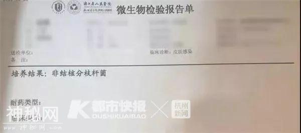 28岁女艺人打“瘦腿针”后险遭截肢！腿上发现“神秘细菌”-4.jpg