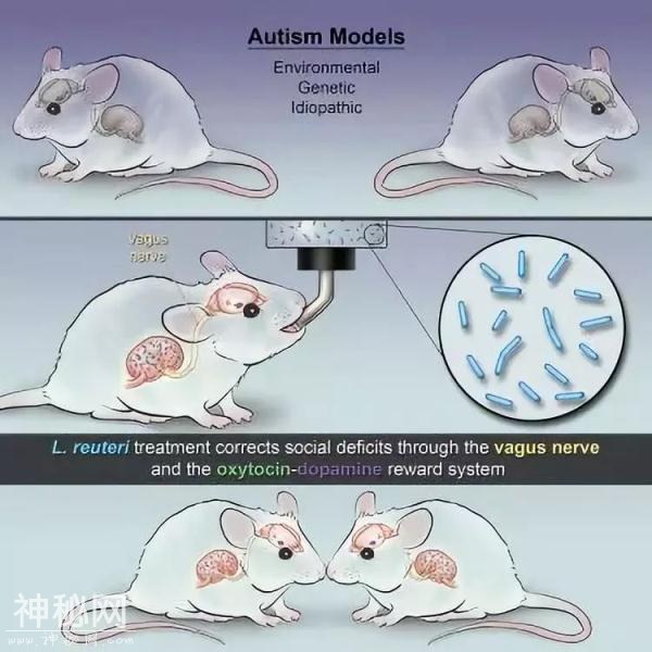 科学认证：自闭症儿童有救！肠道细菌便是救星-7.jpg