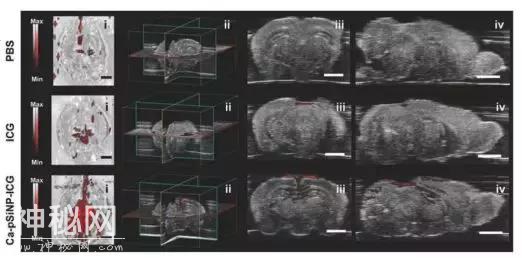 八种生物成像技术，各显神通，你最青睐谁？-9.jpg