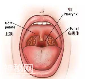 男子咳出自己的扁桃体！惊恐：我是不是得了什么绝症？！-3.jpg