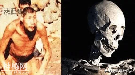 揭秘神农架“野人”！确有其人，遗骨现存中国科学院-5.jpg