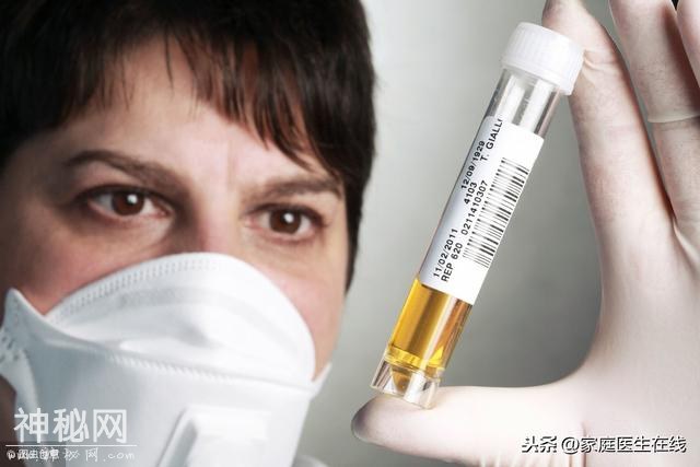 身体出现4个现象，要警惕，第一时间“揪出”尿毒症-2.jpg