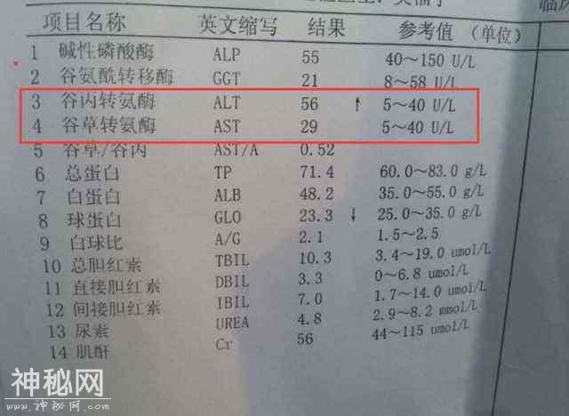 复查乙肝两对半和肝功能 及时判断乙肝病毒变异！-2.jpg