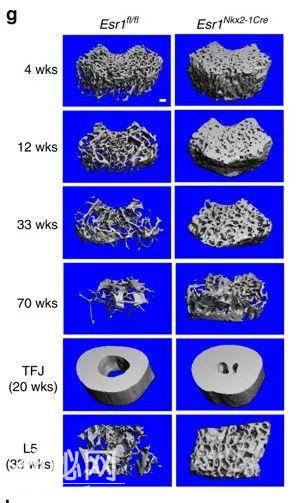 骨质疏松研究获重大突破！甚至实现骨量增加800%……-6.jpg