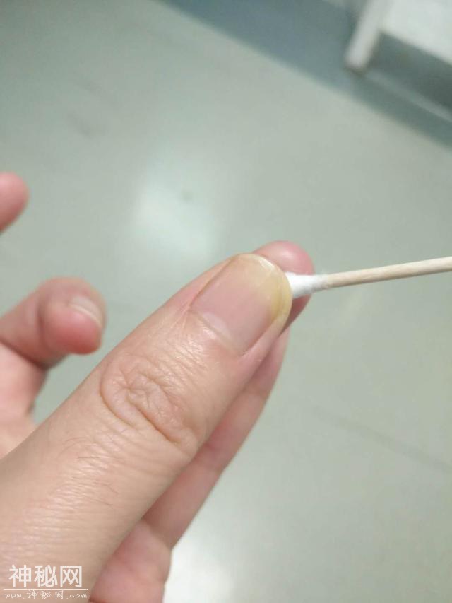 感冒了，如何判断是病毒感染还是细菌感染？-3.jpg