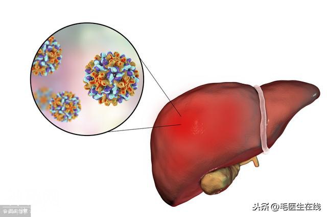 和HIV很相似，这种病毒已经引起约四千万人感染-1.jpg
